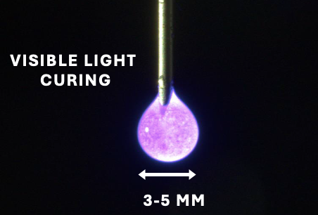 OcuLief implant being cured under visible light. Size 3-5mm